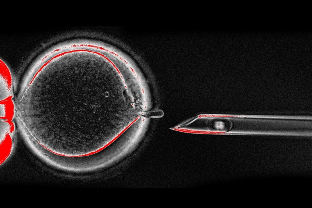 UK moves closer to allowing three-parent babies