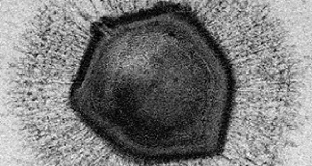 Image 2. 
				" 
				<div dir="auto" style="text-align: center;">
				Mimivirus a type of giant virus.<br> 
				<a href="https://polit.ru/news/2019/11/13/ps_mipt_olpvrii/" target="_blank">
				https://polit.ru/news/2019/11/13/ps_mipt_olpvrii/ </a><br> 
				(This article is in Russian language. Use google translate to English or whatever language of preference)
				</div>
				"