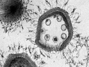 Image 5. 
				" 
				<div dir="auto" style="text-align: center;">
				Sputnik virus inside the giant virus Mamavirus. <br> 
				<a href="https://deskarati.com/2015/05/07/a-virus-infecting-virus/" target="_blank">
				https://deskarati.com/2015/05/07/a-virus-infecting-virus/ </a></div>
				"