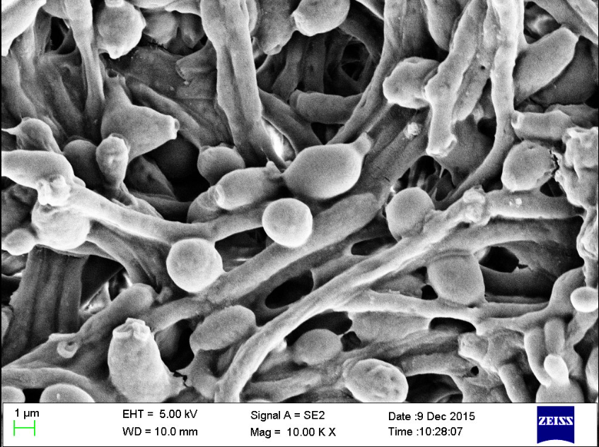 C albicans visualised using scanning electron microscopy. Scanning electrom microscopy was performed at CenSE, IISc, Bangalore