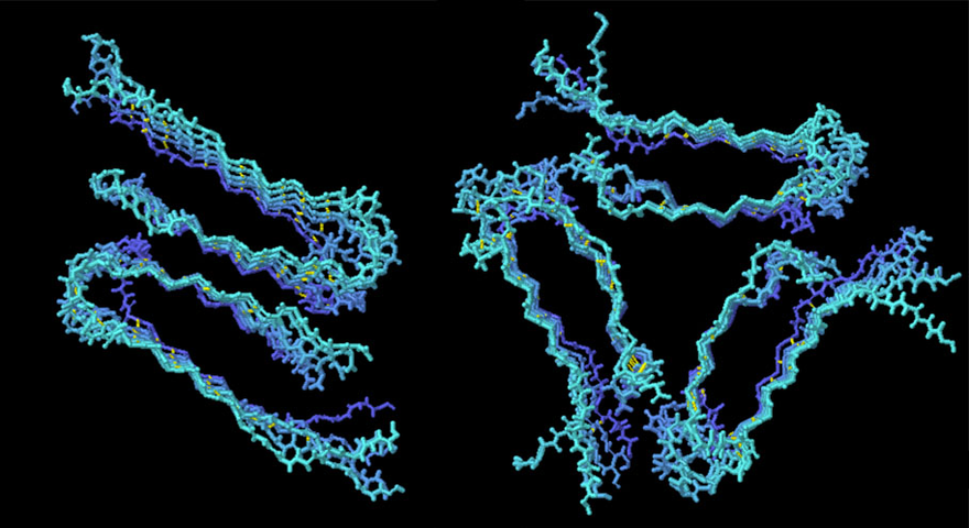 3D-structure of Amyloids and their influence on the biological function.