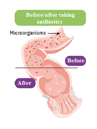 Representation illustrating the selection of resistant strains after antibiotic administration.